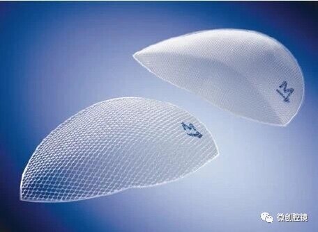 腹股沟疝补片什么样