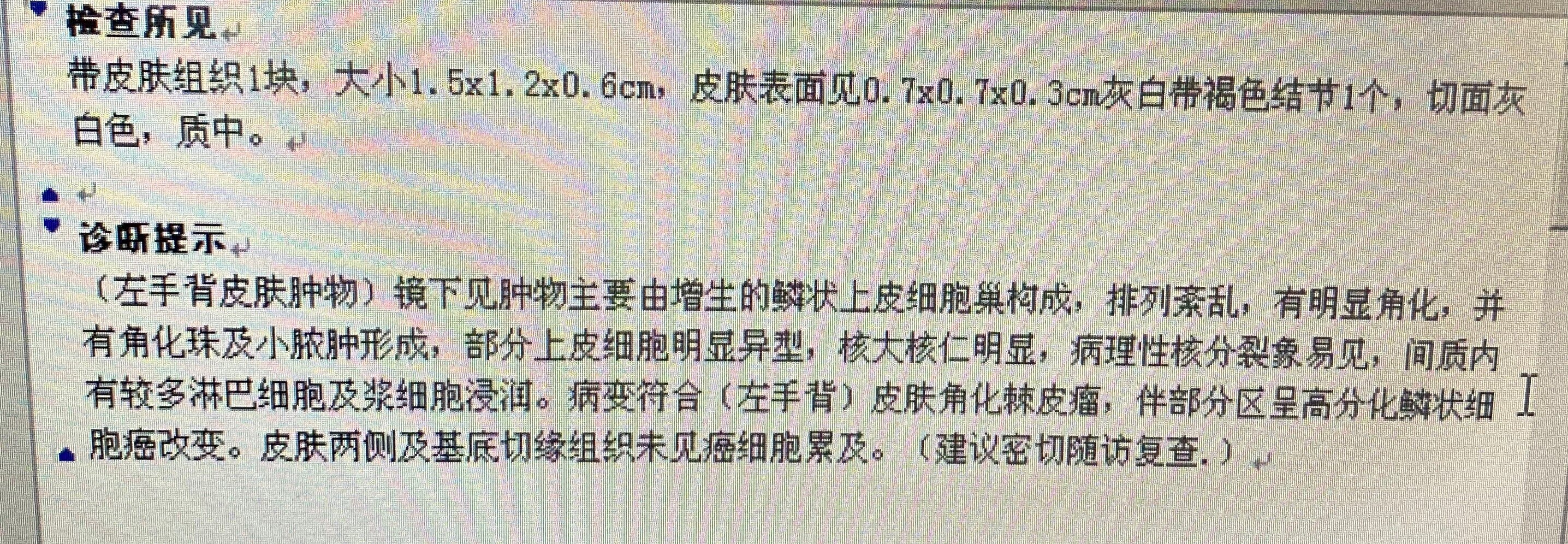 莫把皮肤小肿物不当回事可能就是皮肤癌