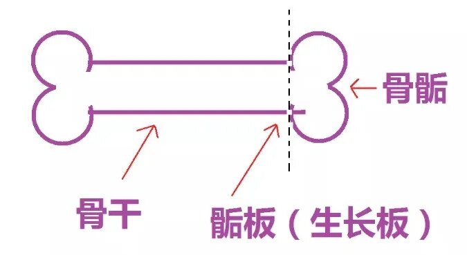 骨骺线闭合的3大标志家长必看