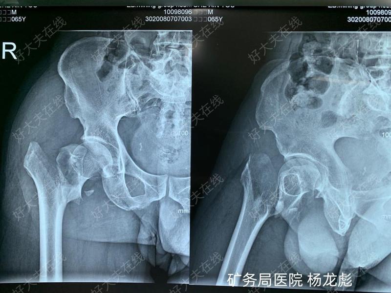 圖文圖片