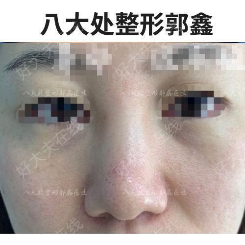 圖文圖片