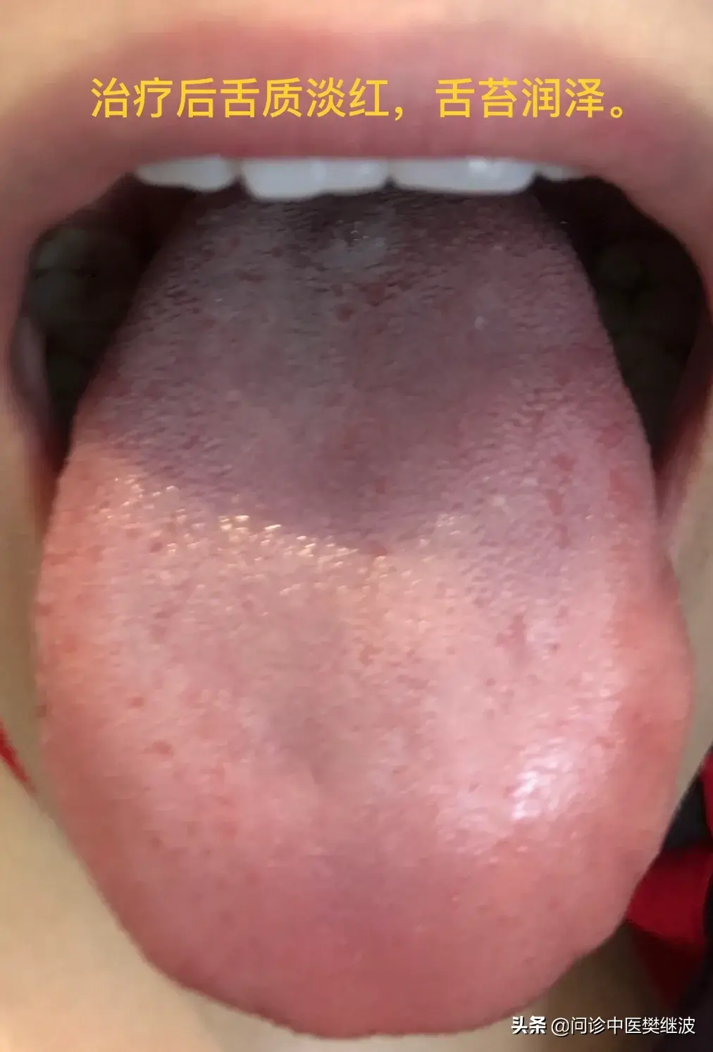 暂无