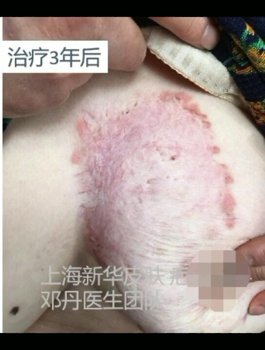 視頻封面