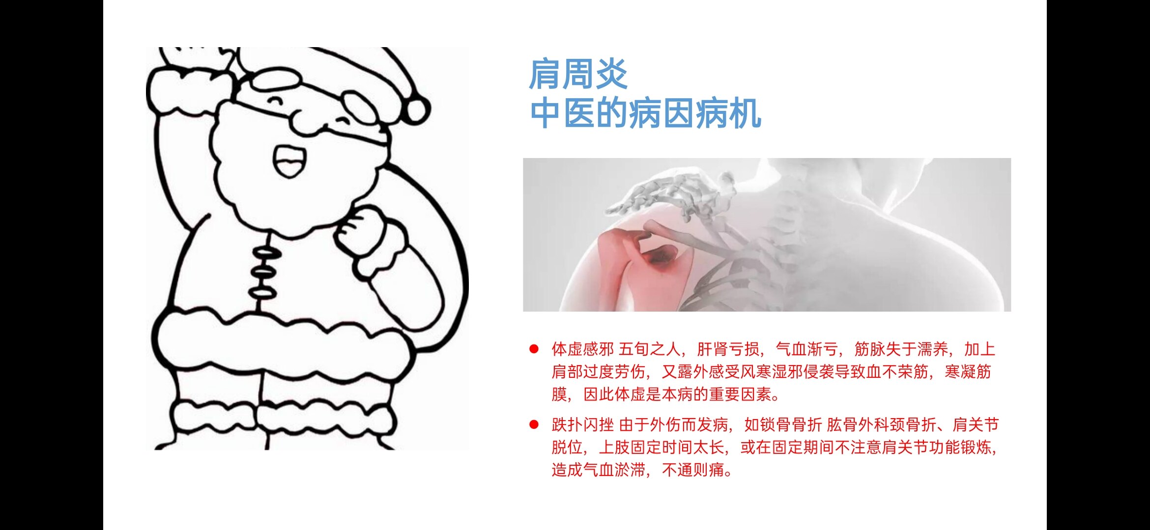 肩周炎的诊断与鉴别诊断 肩周炎 肩周炎 好大夫在线 肩周炎的诊断与鉴别诊断 肩周炎 肩周炎 好大夫在线