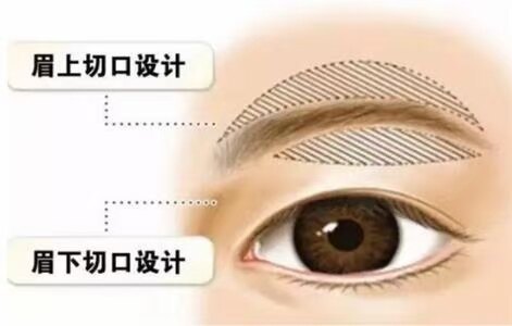 圖文圖片