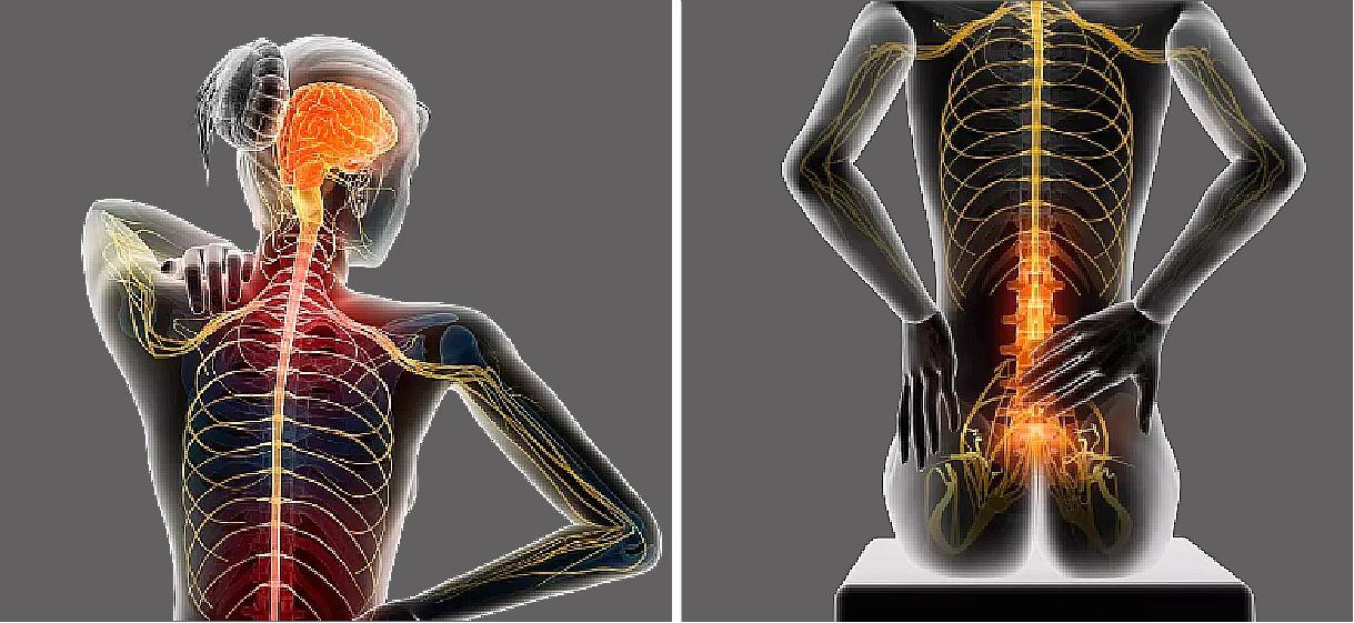 一,由于侵蚀或压迫脊髓及神经根,通常会出现严重的难以忍受的躯体疼痛