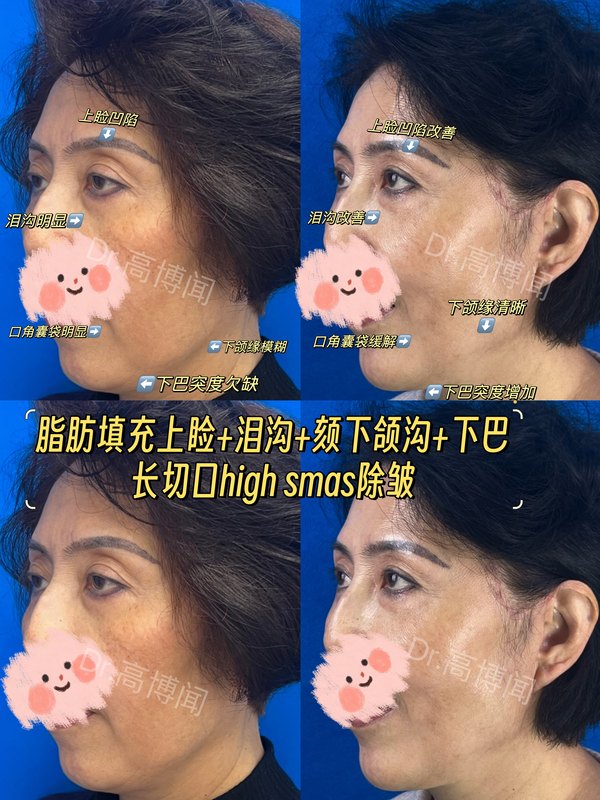 圖文圖片
