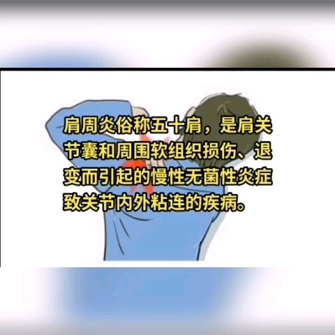 肩周炎哪家医院看得好 治疗肩周炎哪个医生好 肩周炎推荐医院医生 好大夫在线