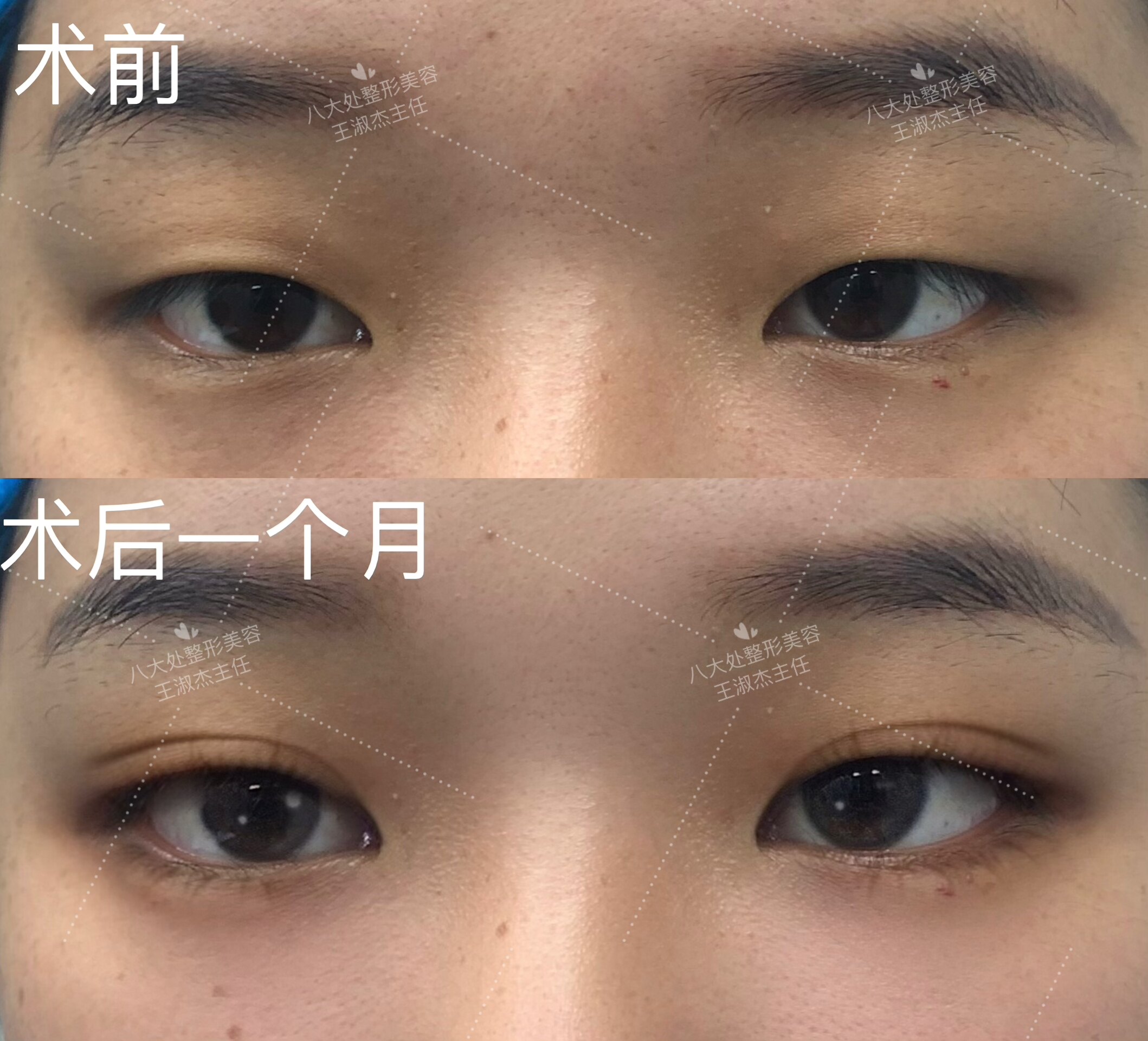 圖文圖片