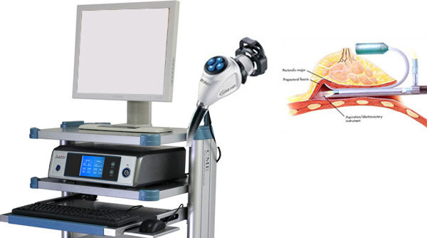 1608341127193707.jpg 内窥镜.jpg