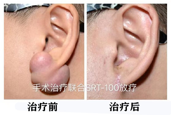 暂无