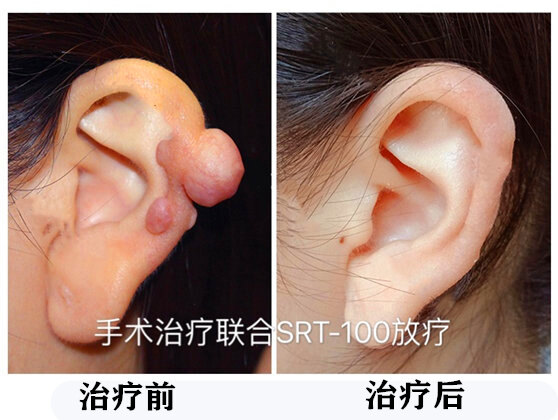 暂无