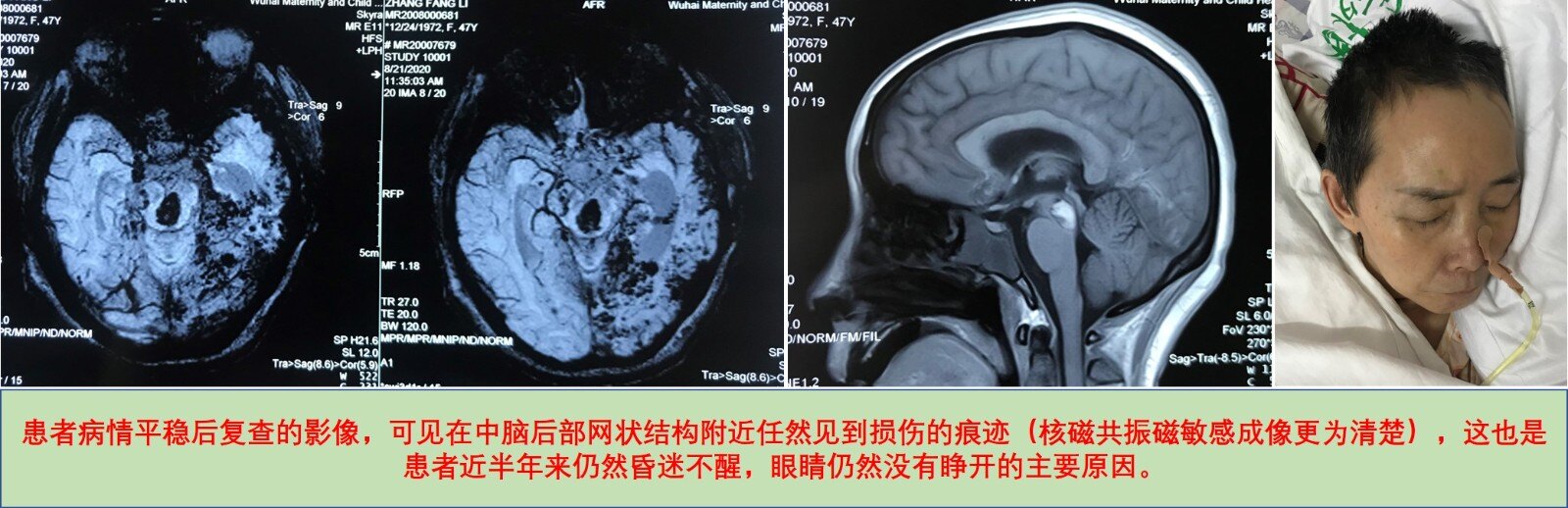 病人术前影像.jpg