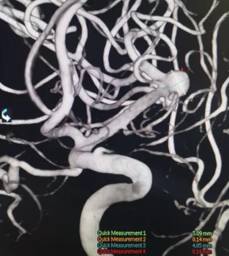 1612320300272964.jpg 微信图片_20210203104312.jpg