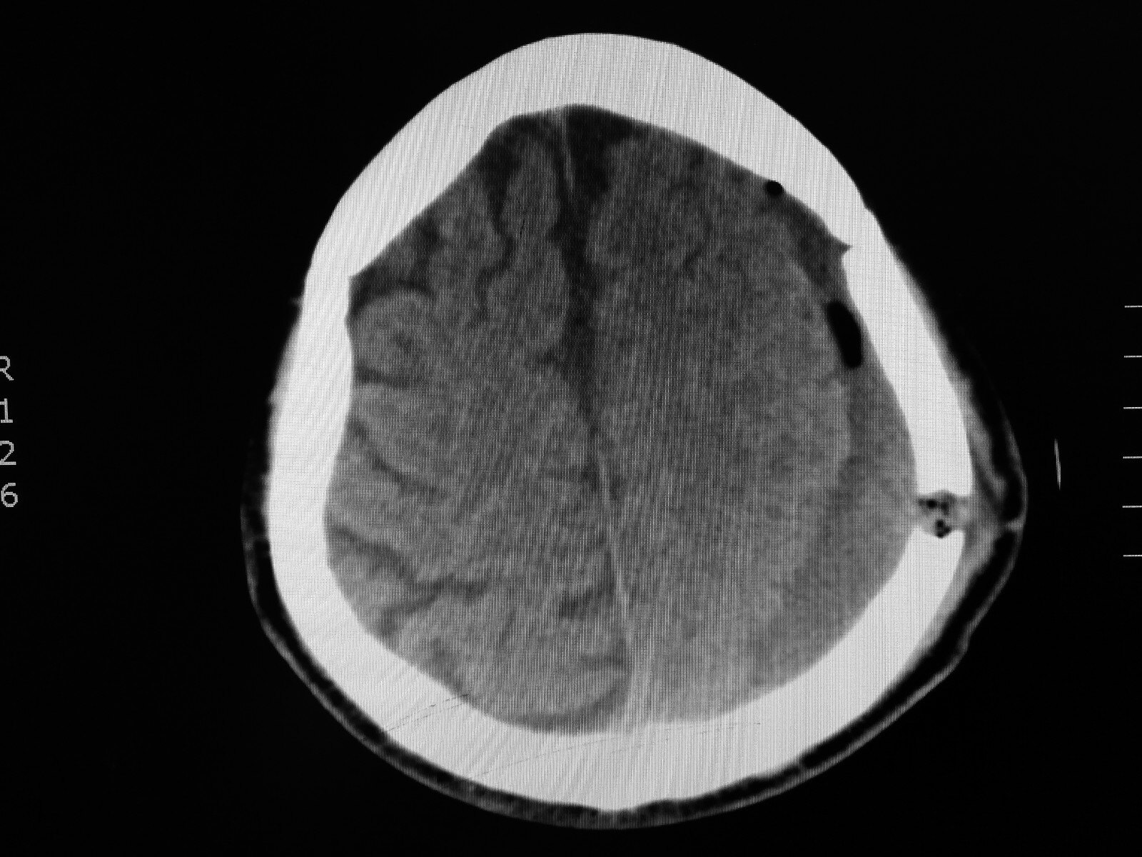 东直门医院医院预约CT加急-东直门医院医院预约ct加急多少钱 