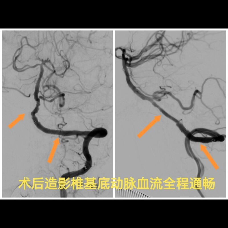 視頻封面