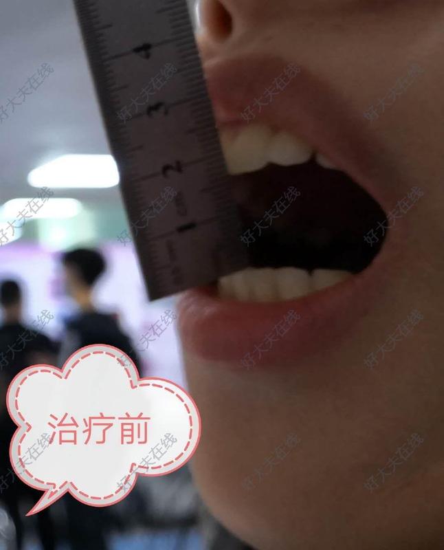 圖文圖片