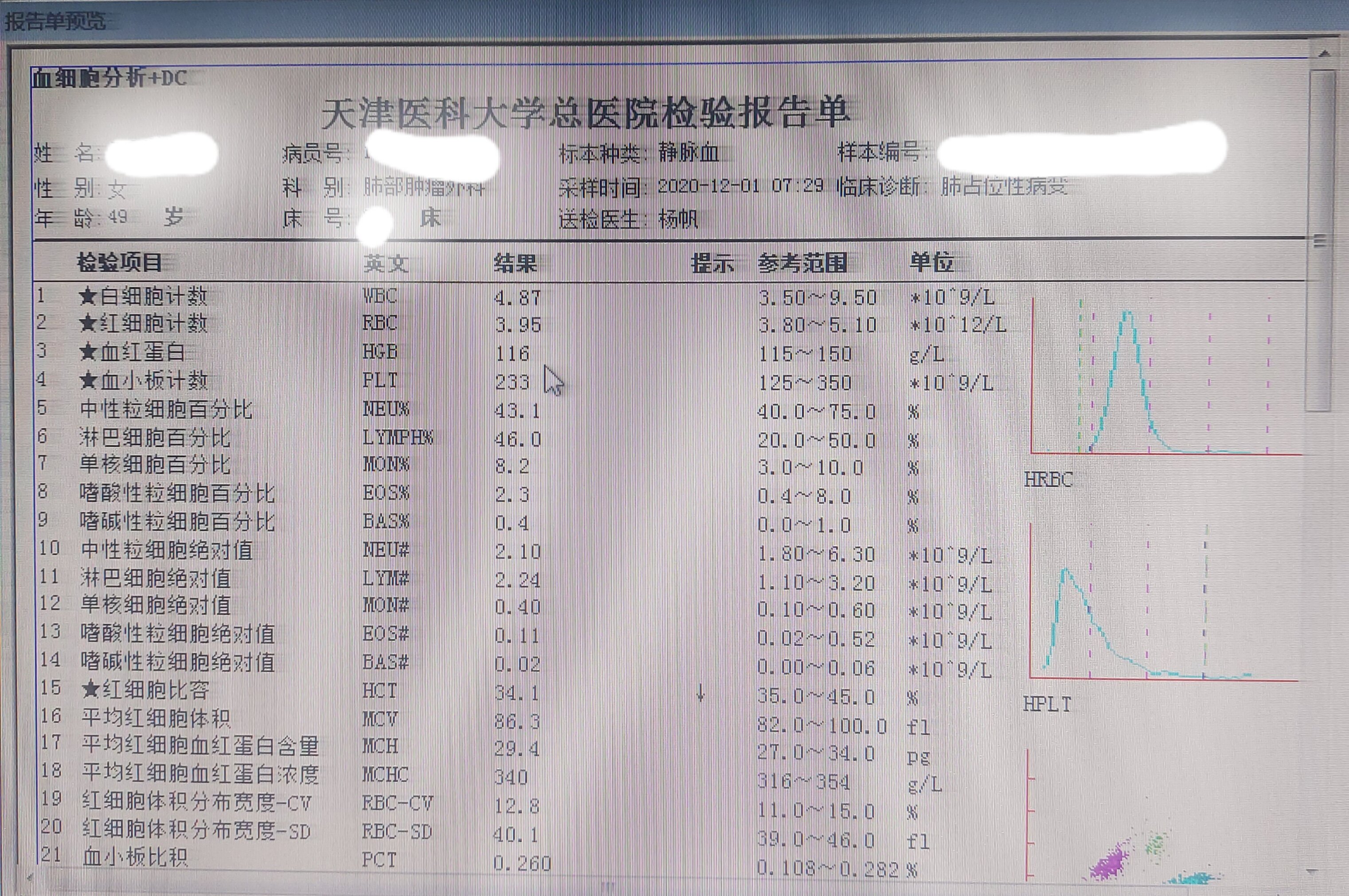 血红蛋白低是怎么回事图片