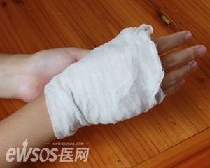 烧伤急救全过程图解 - 好大夫在线