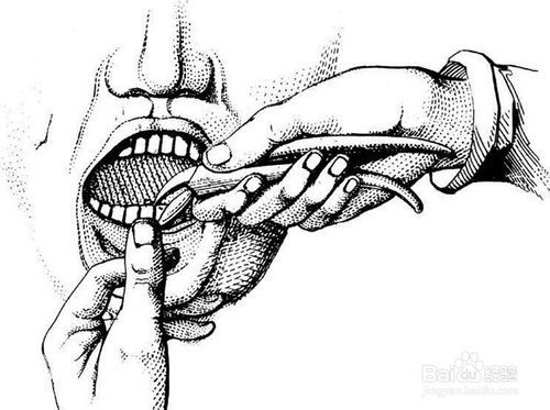 拔牙时间的选择关于拔牙的那些事壹