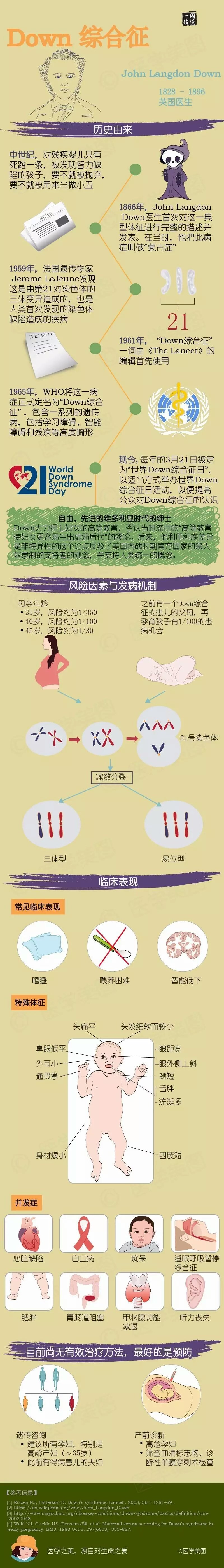 你知道什麼是唐氏綜合症麼?