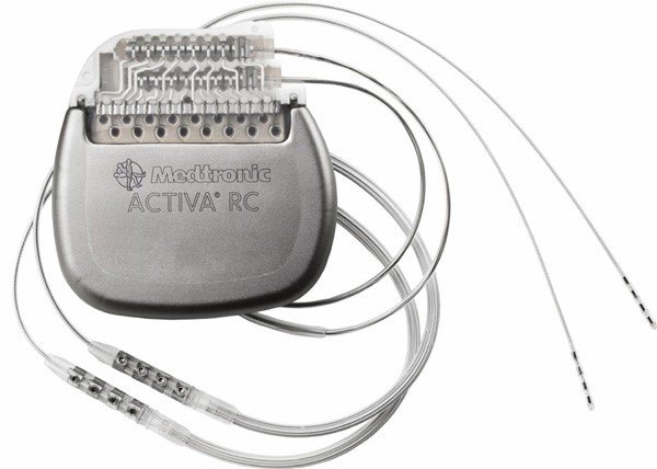 脑起搏器治疗帕金森病的几个问答