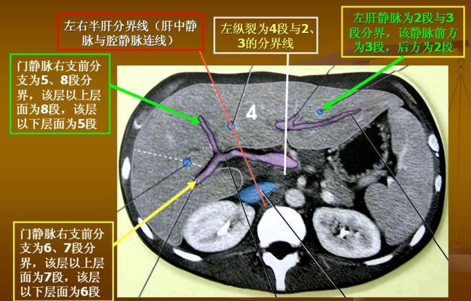 肝区s5的位置示意图图片