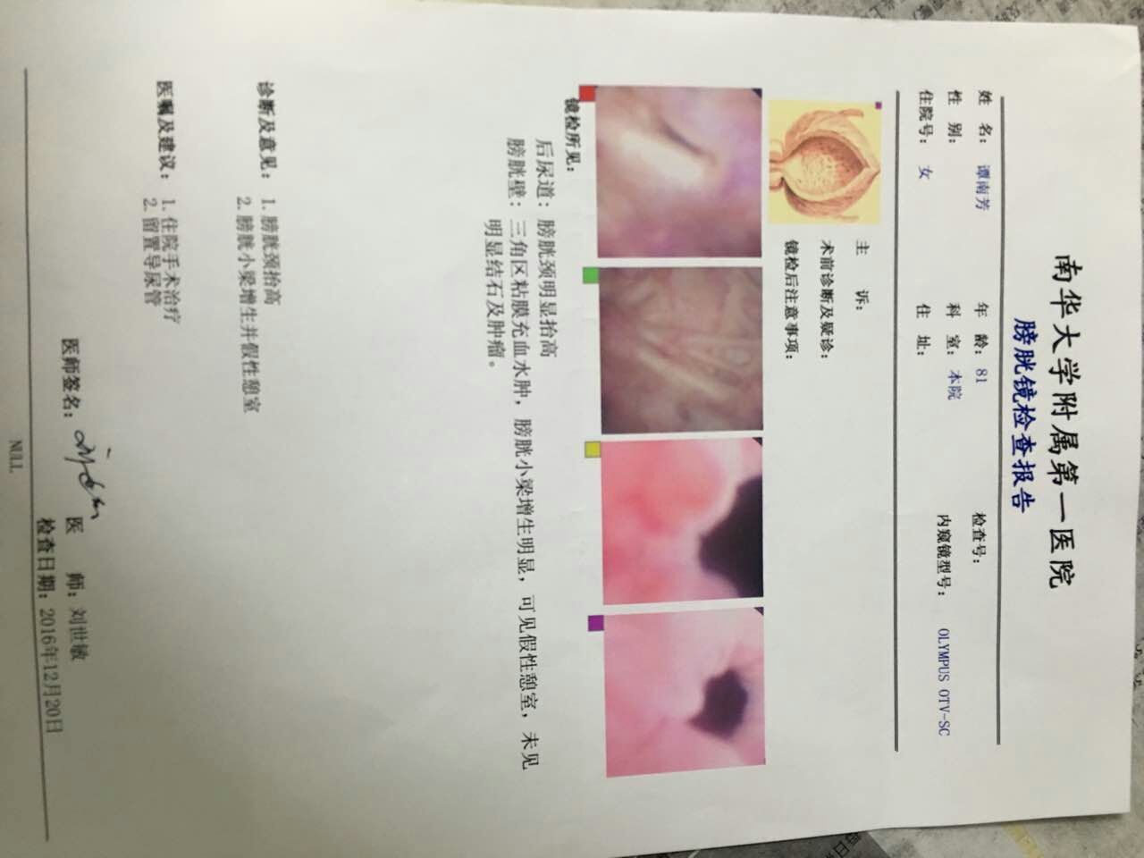 女性非神经源性排尿困难的诊断和治疗