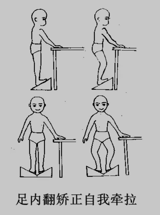 【图文示例】脑瘫患儿足内翻训练