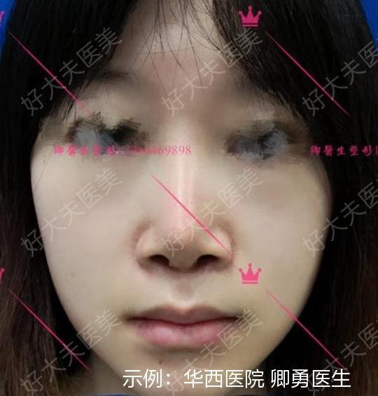 圖文圖片
