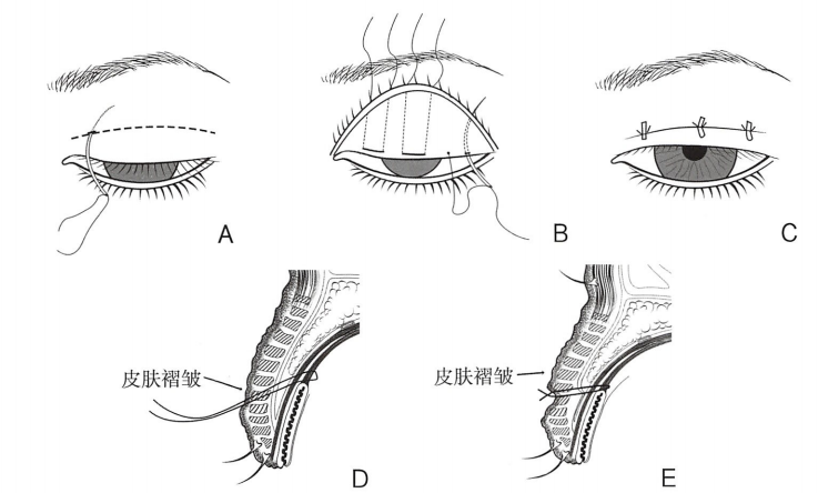 卧蚕怎么画简单又漂亮 uoYBAFy7-A2AbCpqAAKTlf2Rfco490.png?_ms_=c643