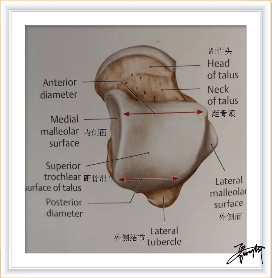 踝关节由距骨,胫骨远端,内踝,外踝构成,距骨分为距骨头,颈,体(滑车)