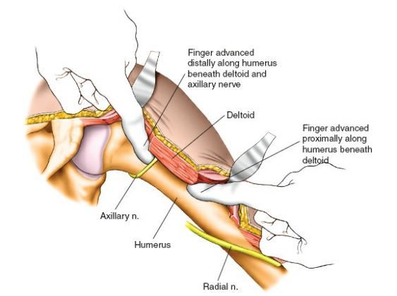 腋神经的解剖有什么基本特点? 