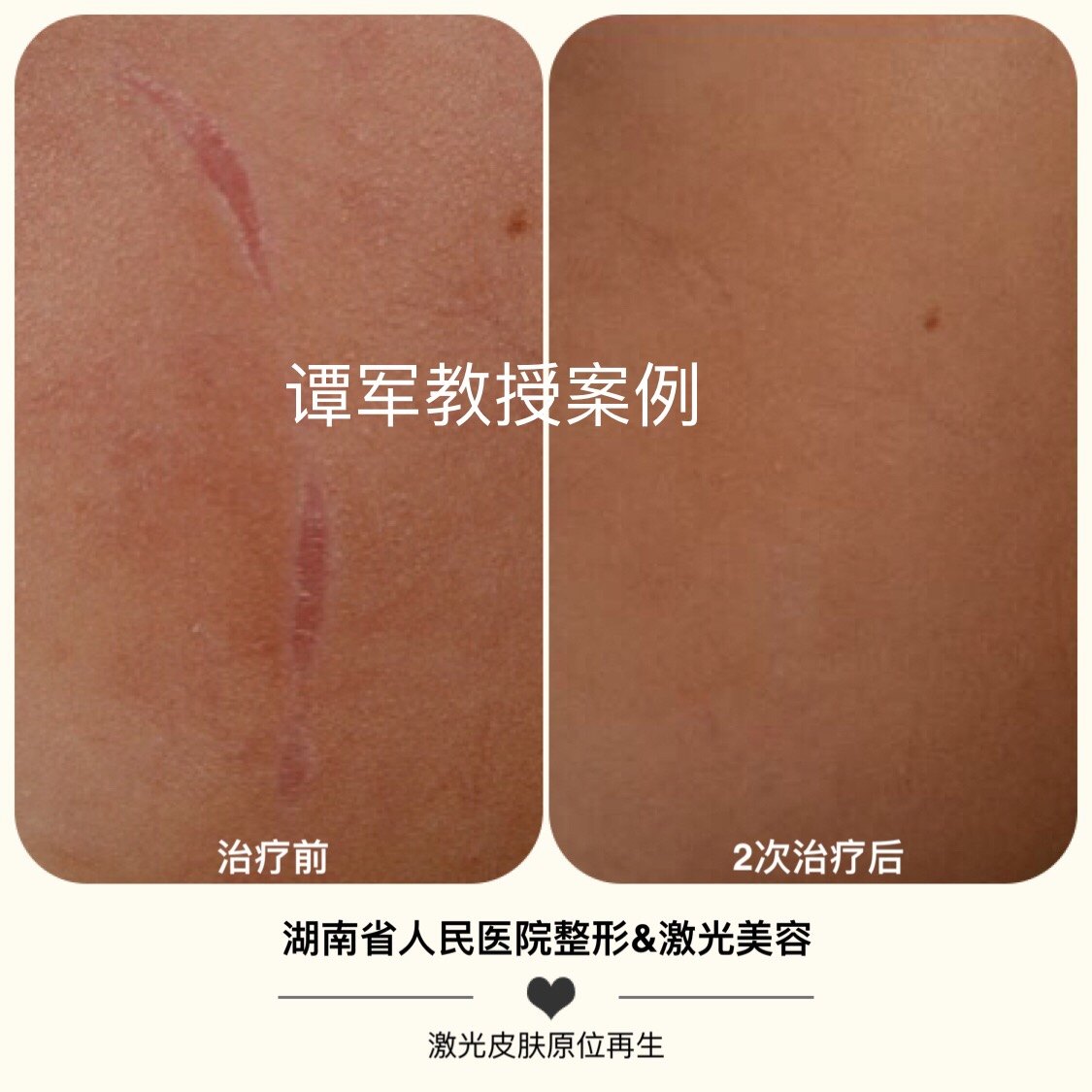 end本文是谭军版权所有,未经授权请勿转载.