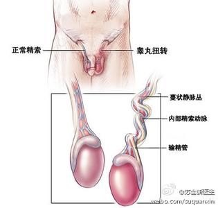 巨大睾丸