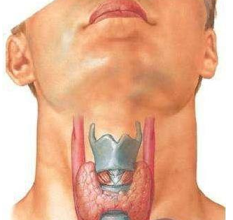 甲状腺结节图片 男性图片