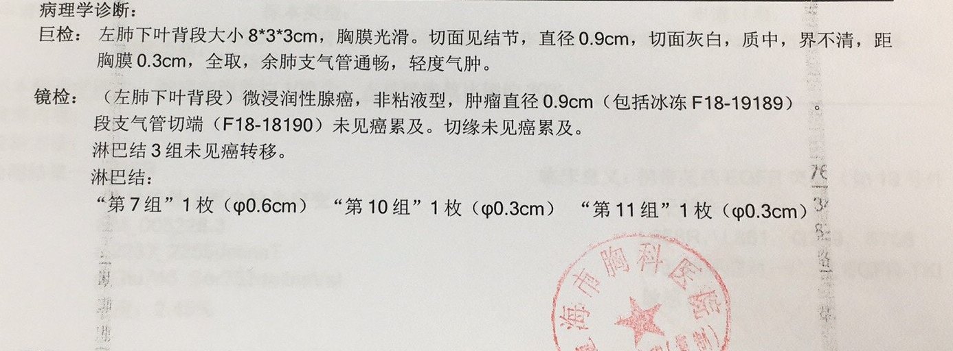 劉懿博士說肺癌七八六9毫米肺結節是微浸潤腺癌能給切乾淨麼