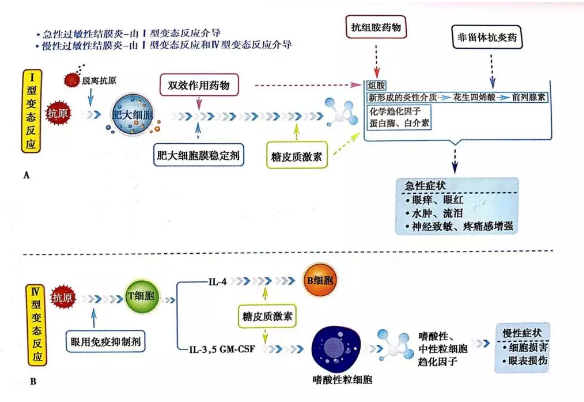 春季系列之——过敏性结膜炎的临床诊断与治疗