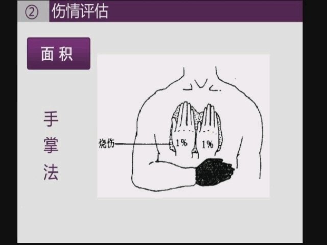 視頻封面