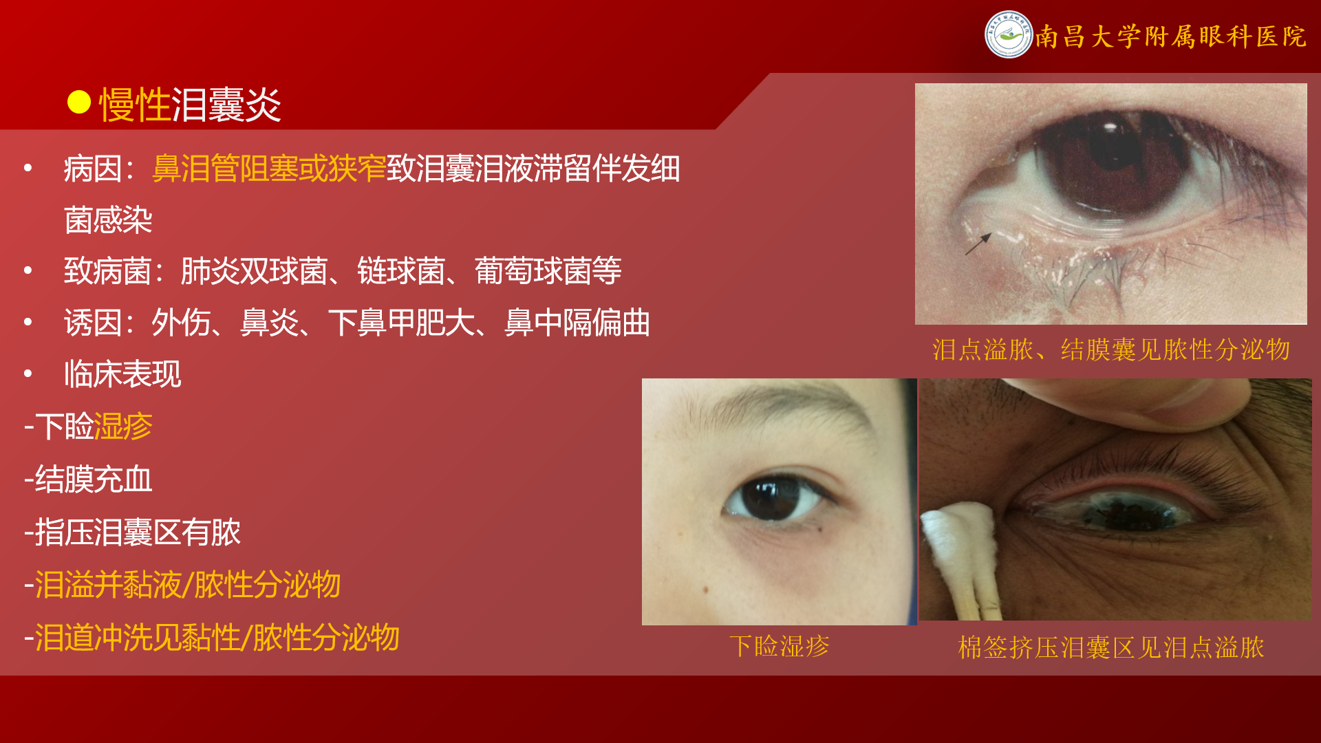 “泪囊炎”如何治疗? - 好大夫在线