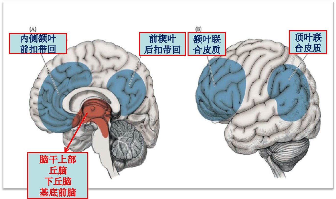 解析弥漫性轴索损伤原发性脑干伤导致昏迷的原因