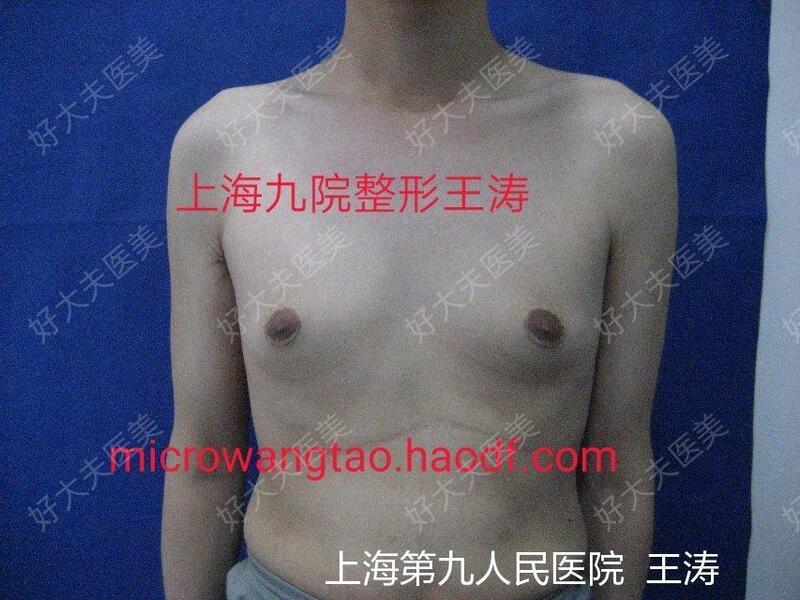 圖文圖片