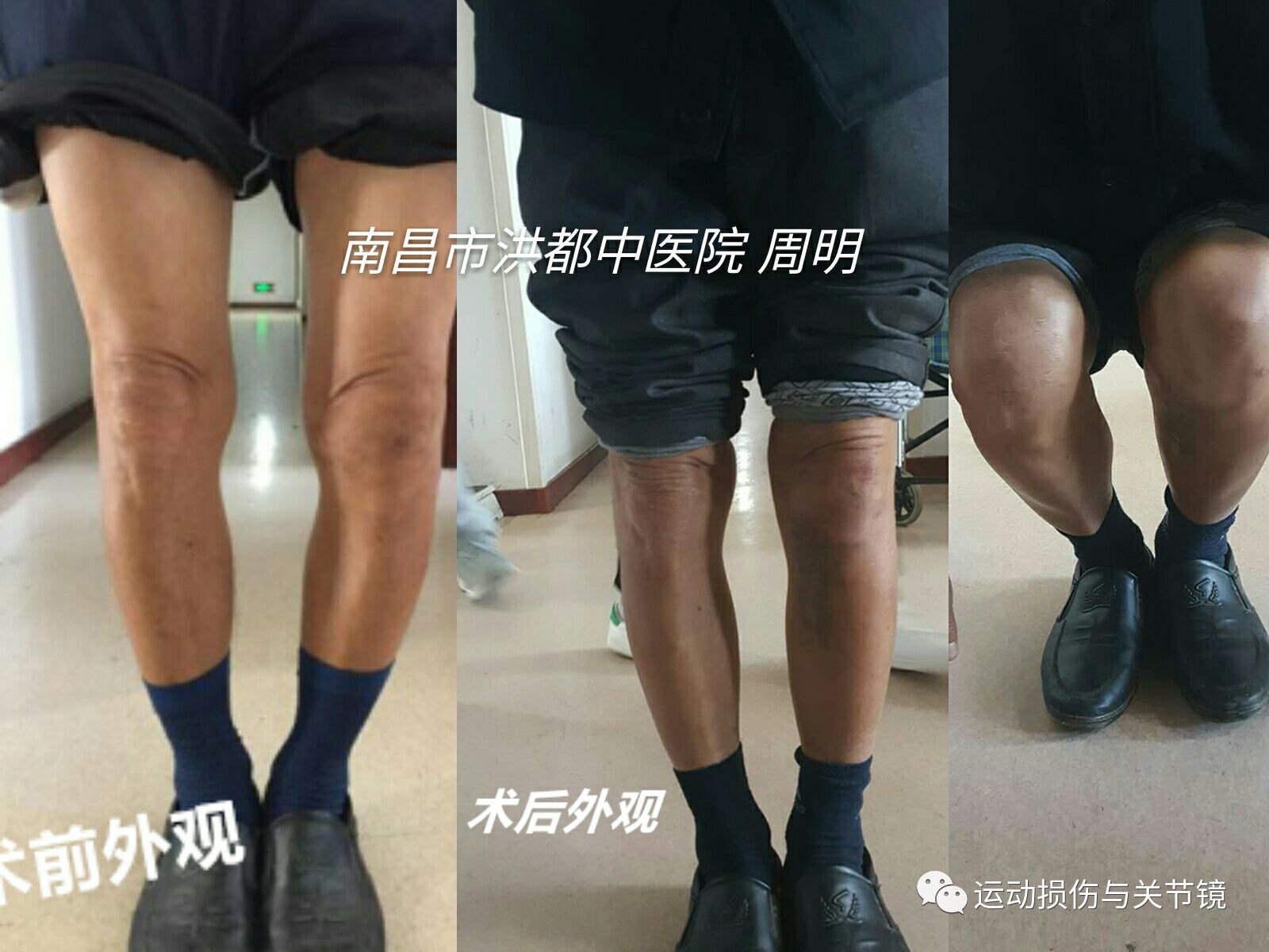 暂无