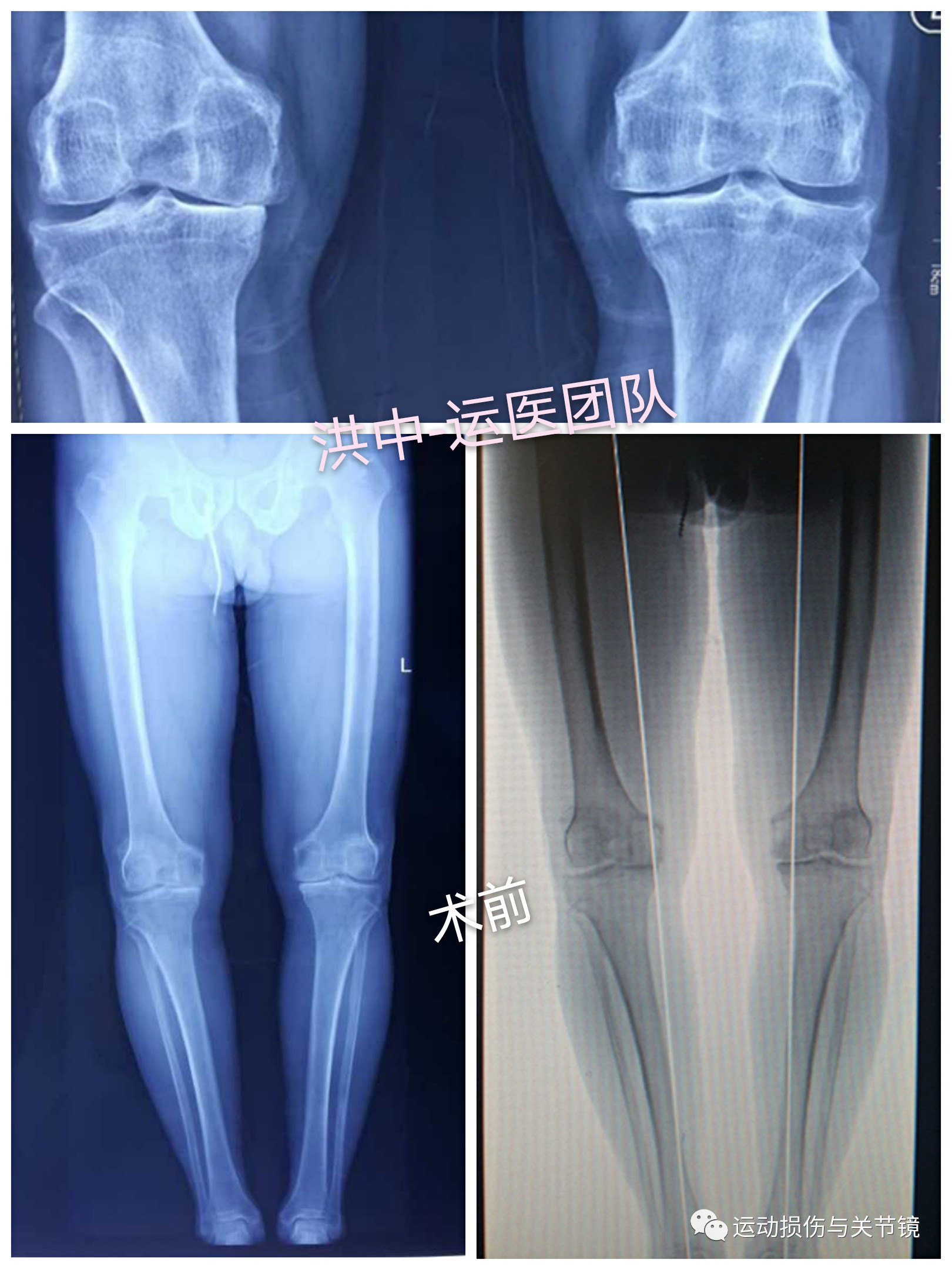 暂无