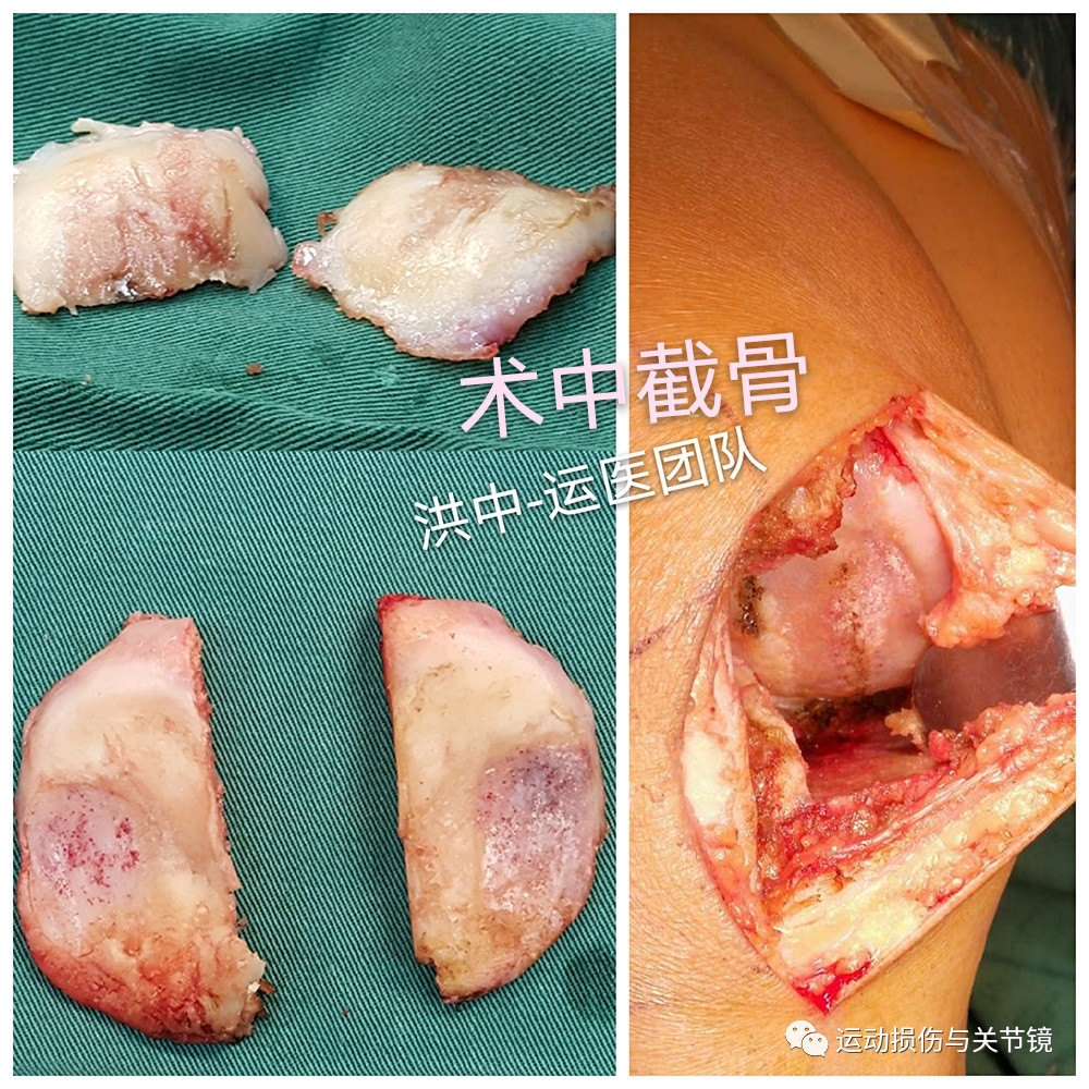 暂无
