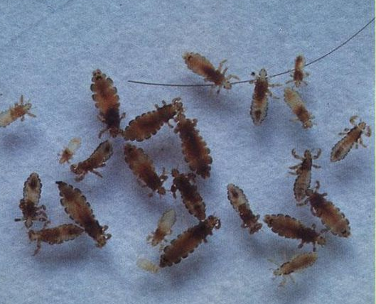 虱什么什么痒的成语_成语口中蚤虱图片