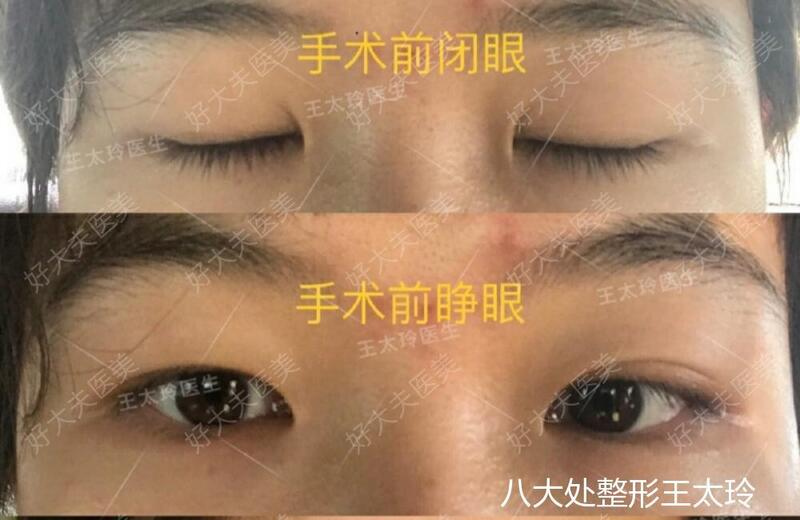 圖文圖片