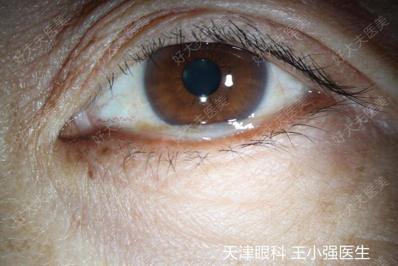 圖文圖片