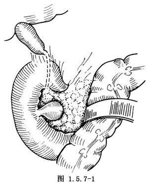 大肠素描图图片