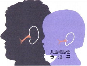 儿童咽鼓管功能障碍的治疗 - 好大夫在线